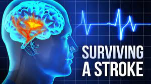 Whole Food Plant-based Diet And Lower Stroke Risk - Research Proof